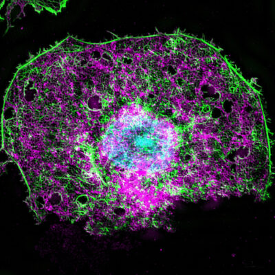 Fluoreszenz-mikroskopische Aufnahme einer Leber-Endothelzelle