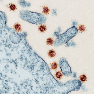 Mikroskop-Bild vom SARS-Coronavirus-2
