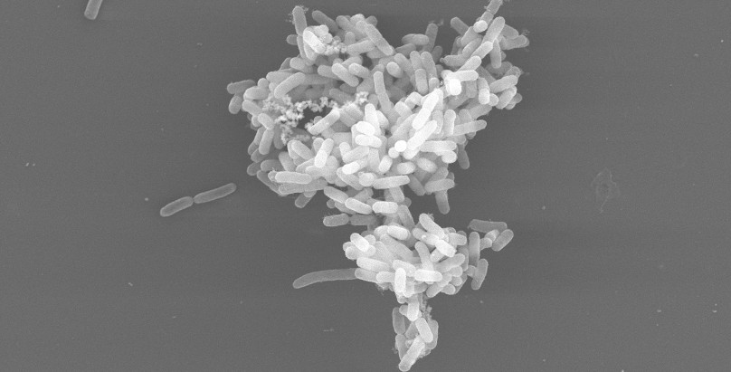 Mehrzelliges/ vielzelliges Cluster der Bakterienart Escherichia col