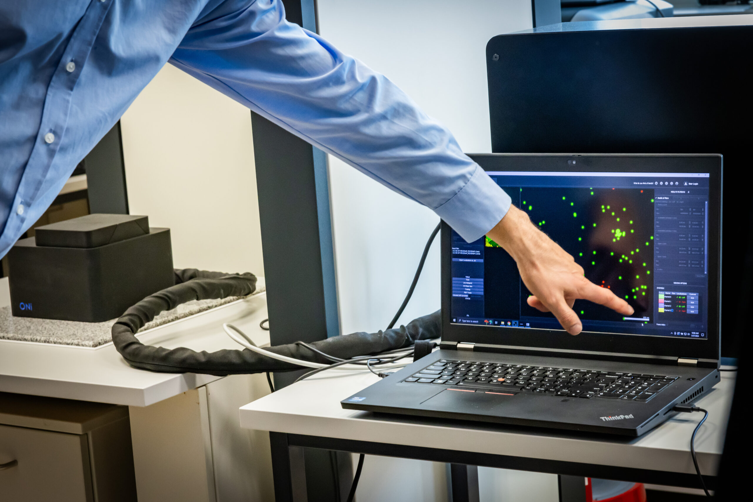 Hand zeigt auf einen Laptop, auf dem das Bild eines Lokalisationsmikroskops zu sehen ist.