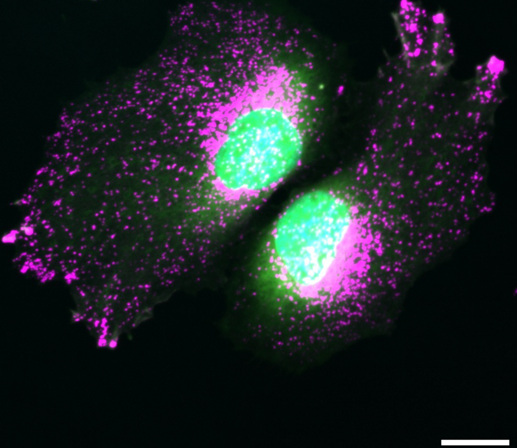 Zellen unter einem Mikroskop eingefärbt.