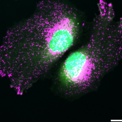 Zellen unter einem Mikroskop eingefärbt.